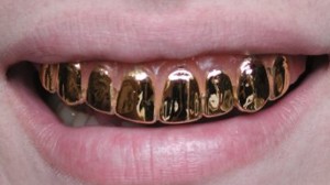 goldteeth 300x168 Золотые зубы спасают от пуль