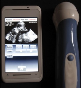 mobius ultrasound 276x300 Медицинский смартфон