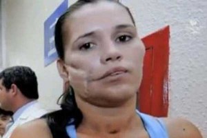Karla Flores grenade 300x200 Мексиканка пережила попадание гранаты в лицо