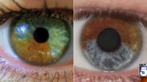 browneyeblueds 300x168 Изменить цвет глаз легко